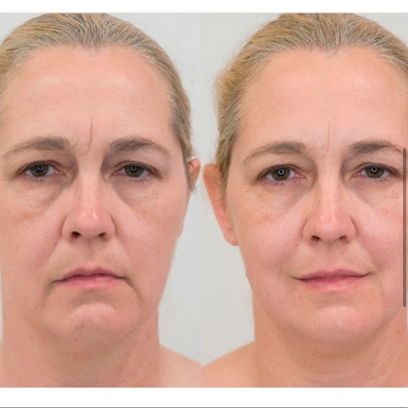 Cosmedix Beauty Roller - Picture 4 of 5